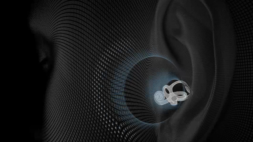 深圳再添一海外大卖！靠冷门技术爆赚60亿！杀入出海品牌TOP10